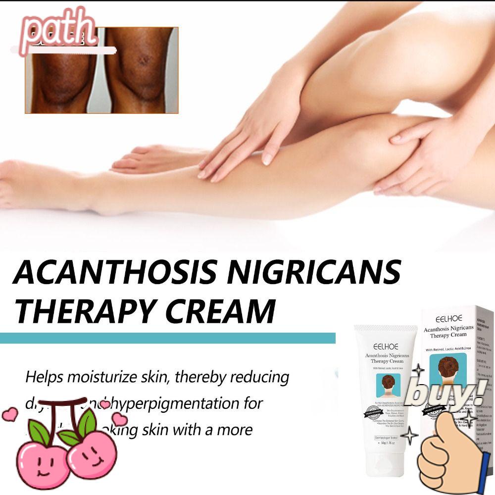 Kem Hỗ Trợ Giảm Quầng Thâm Và Đốm Đen Trên Da Nigrifree