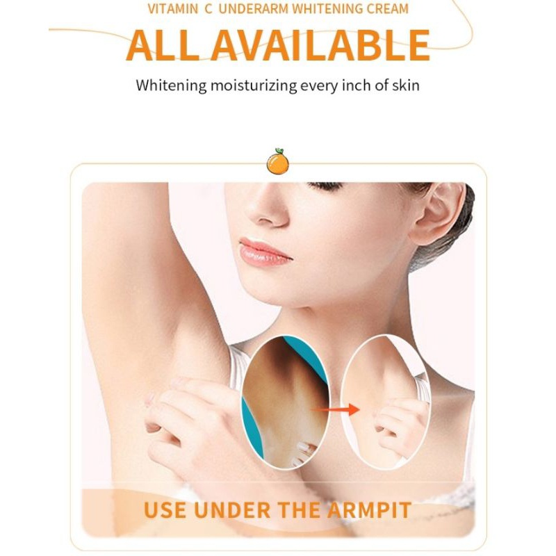 Sadoer Vitamin C Nách Dưỡng Trắng Kem Tẩy Trắng Vùng Riêng Tư Khỏe Mạnh Loại Bỏ Hắc Tố Melanin Đầu Gối Cánh Tay Dưỡng Thể Chăm Sóc Da Produit heby1