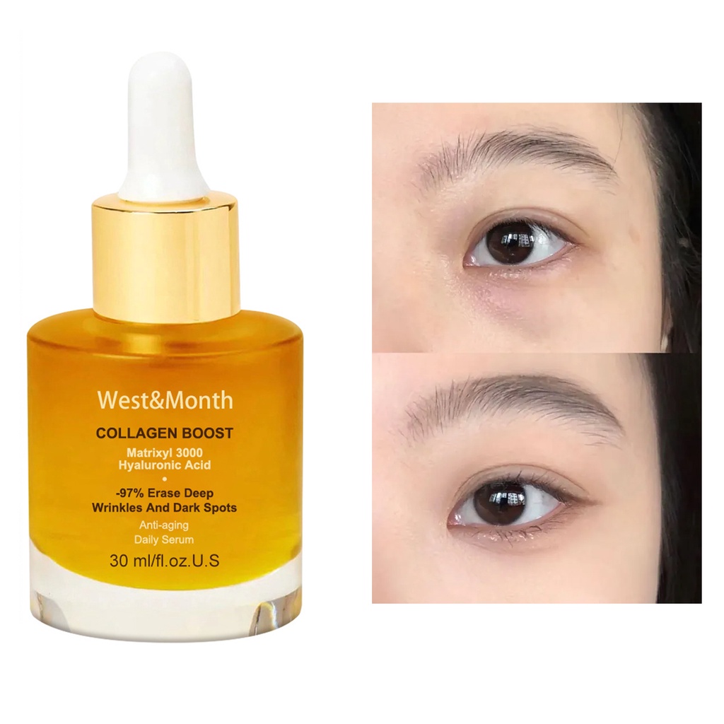 Tinh Chất Collagen 30ml Chống Lão Hóa Làm Săn Chắc Da Thích Hợp Cho Mọi Loại Da