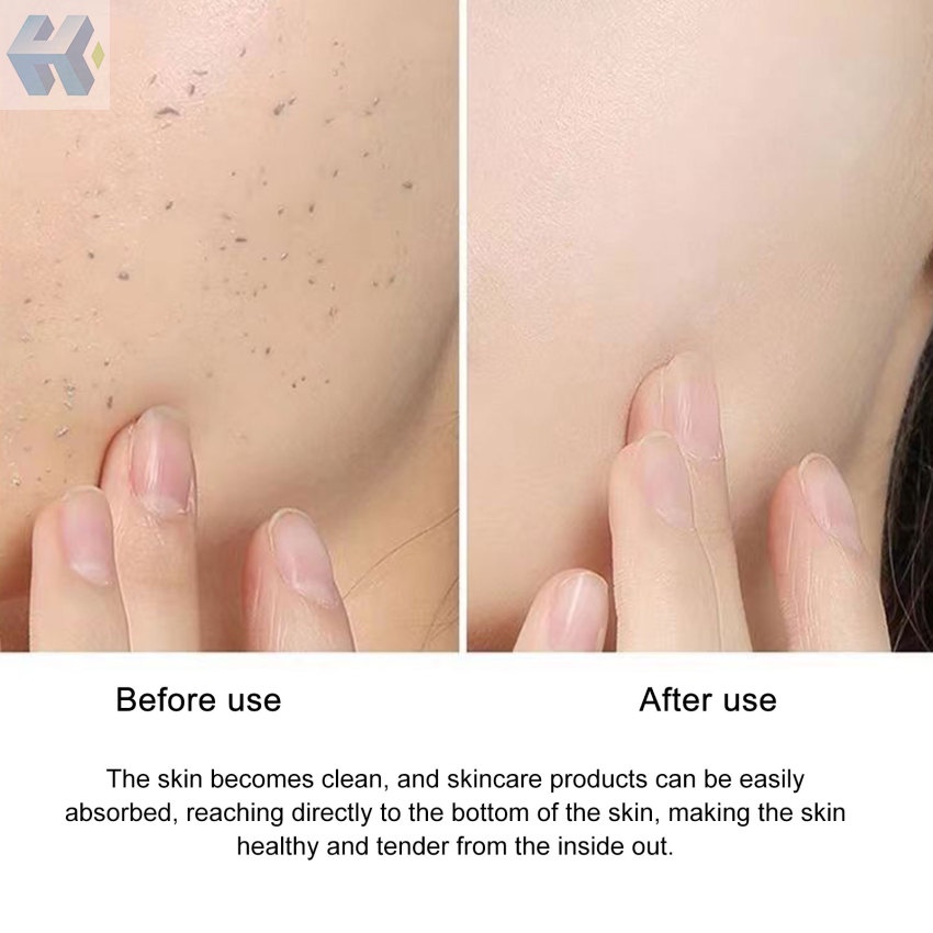 Gel Tẩy Tế Bào Chết Làm Sạch Sâu Dưỡng Ẩm Nhẹ Nhàng ROLANJONA VC