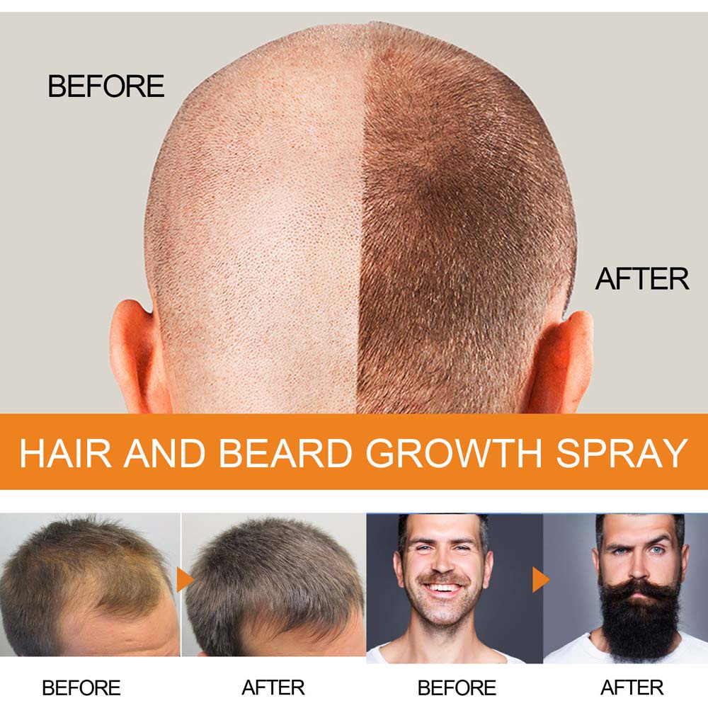 Jayswing Hair Growth spray Beard and Hair Dense Care Fluid 100ml