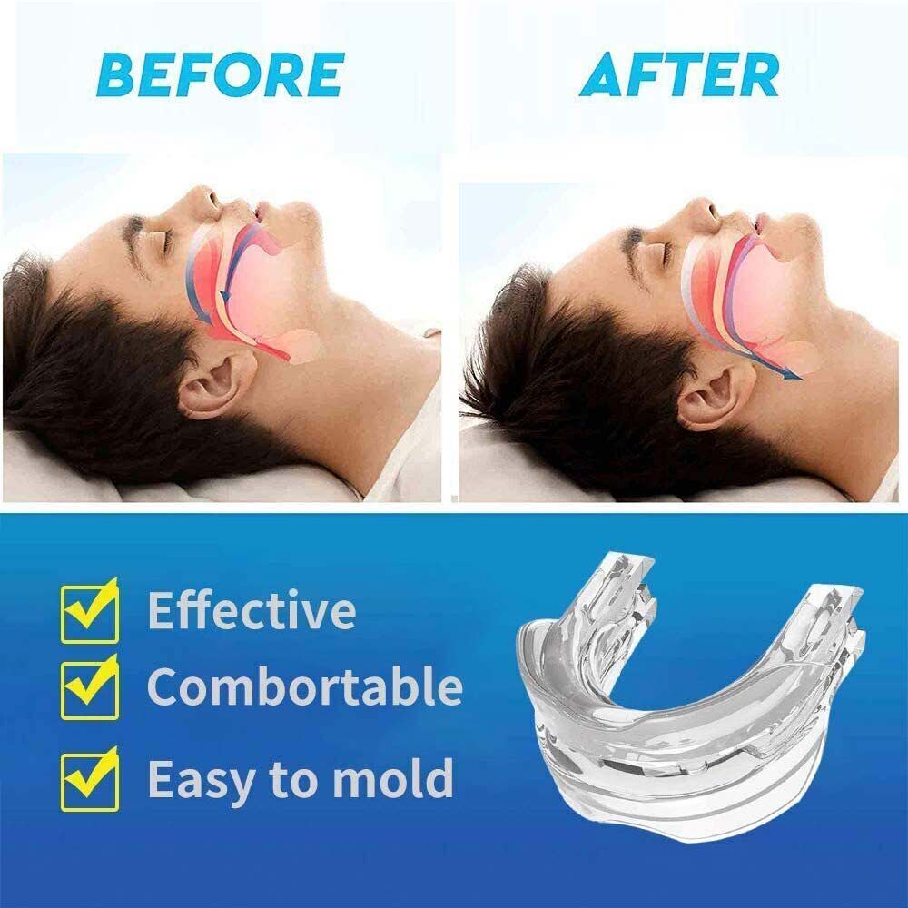 Snore Eliminator Multi-Adjustable Anti Snoring Mouth Guard | Bruxism Sleep Aid Mouthpiece