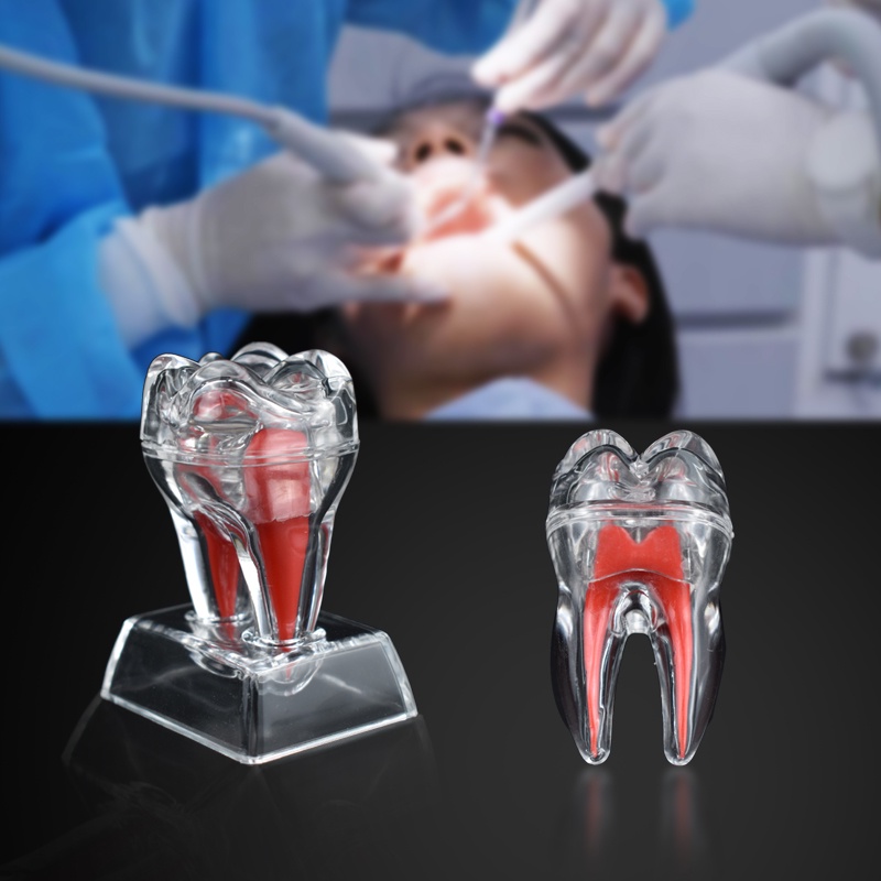 Mô Hình Hàm Răng Giải Mã Nha Khoa Chuyên Dụng Cho Giảng Dạy