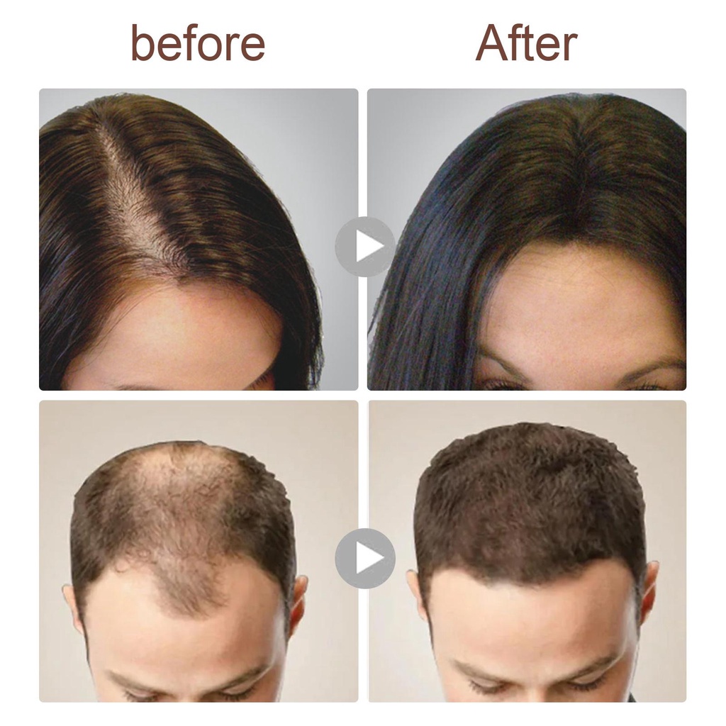 Dầu Gội Đầu Chiết Xuất Gạo G2D0 100g Dưỡng Ẩm Kích Thích Mọc Tóc