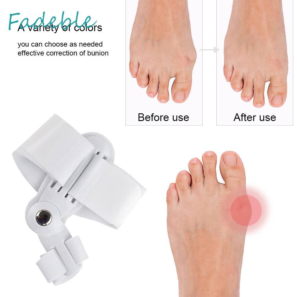 Dụng Cụ Nẹp Chỉnh Hình Ngón Chân Cái