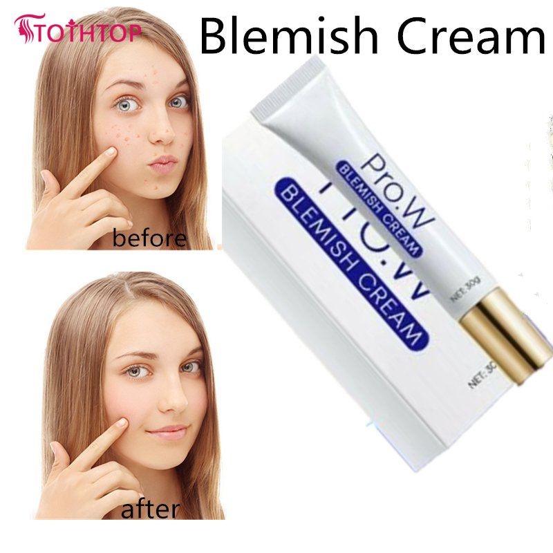 Kem trị mụn Pro.w 30g Kem dưỡng da mặt Kiểm soát dầu cho các đốm tàn nhang Mụn trứng cá Sẹo thâm / Kem trị mụn Pro.w Kem tẩy tế bào chết Kem trị mụn cho da mặt