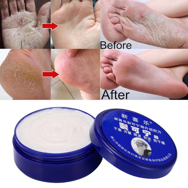 33g 55g Kem dưỡng da chân chống nứt nẻ Mặt nạ khô da gót chân Kem phục hồi vết nứt nẻ tay Loại bỏ vết chai da chết Chăm sóc bàn tay bàn chân AubessDS