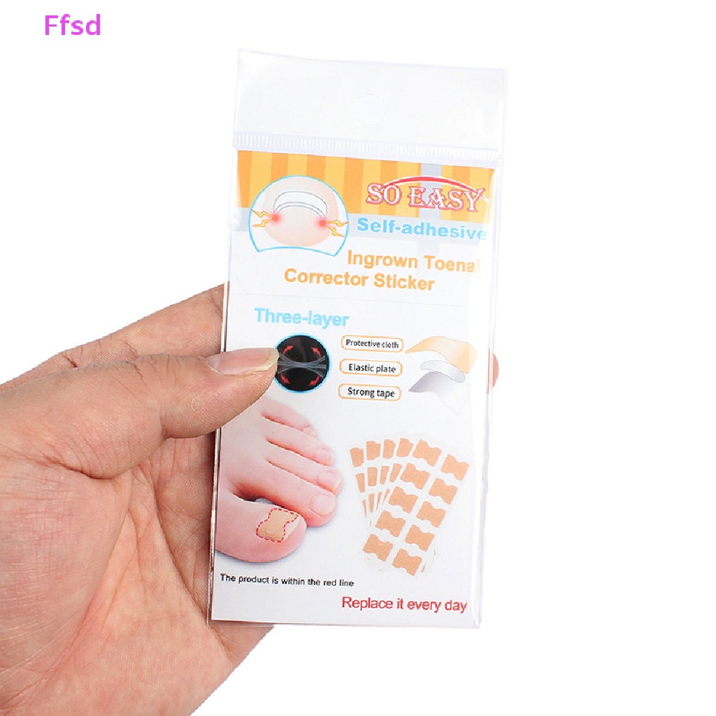 Set 50 Miếng Dán Chỉnh Sửa Móng Chân Mọc Ngược Tiện Dụng