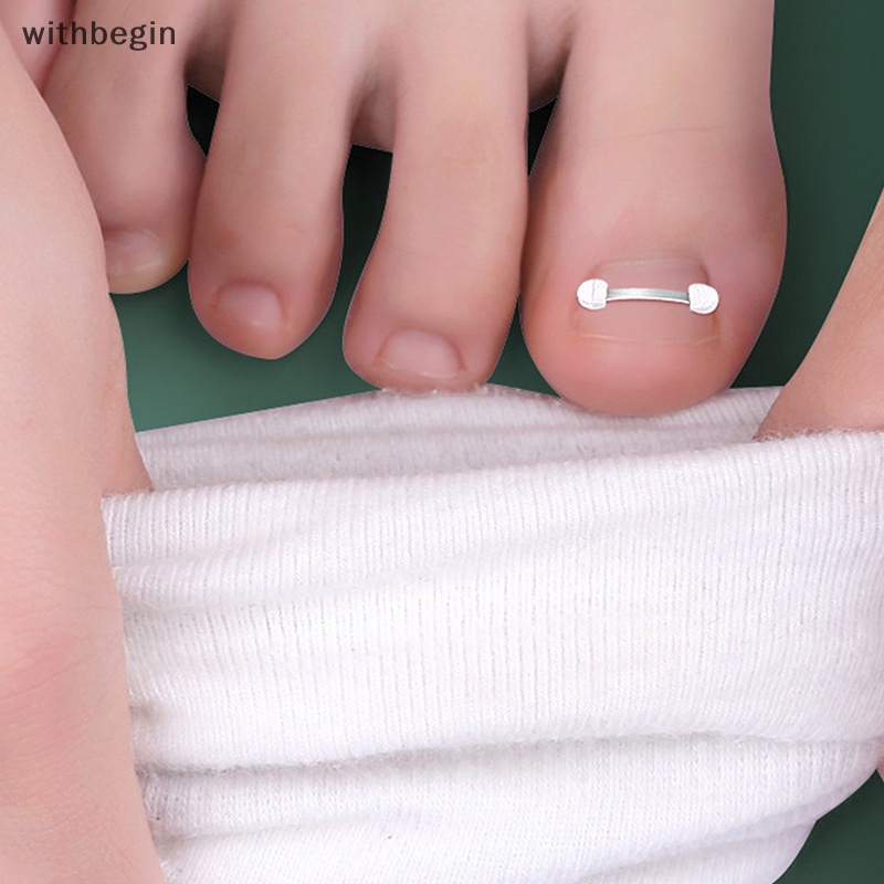 Miếng Dán Chỉnh Sửa Móng Chân Mọc Ngược Tiện Dụng