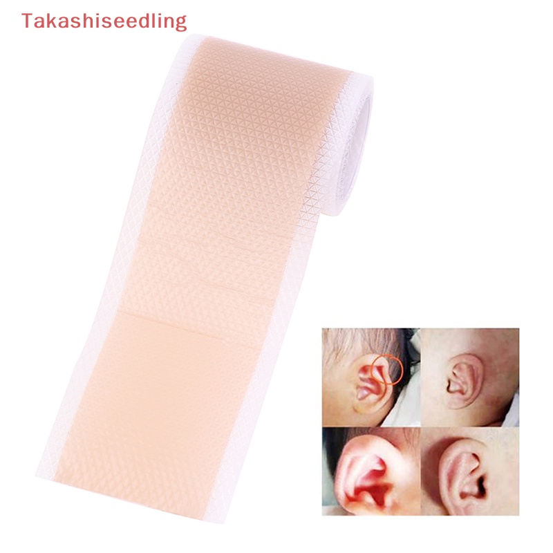 (Takashiseedling) Đai Chỉnh Tai Chỉnh Sửa Tư Thế Cho Bé Sơ Sinh