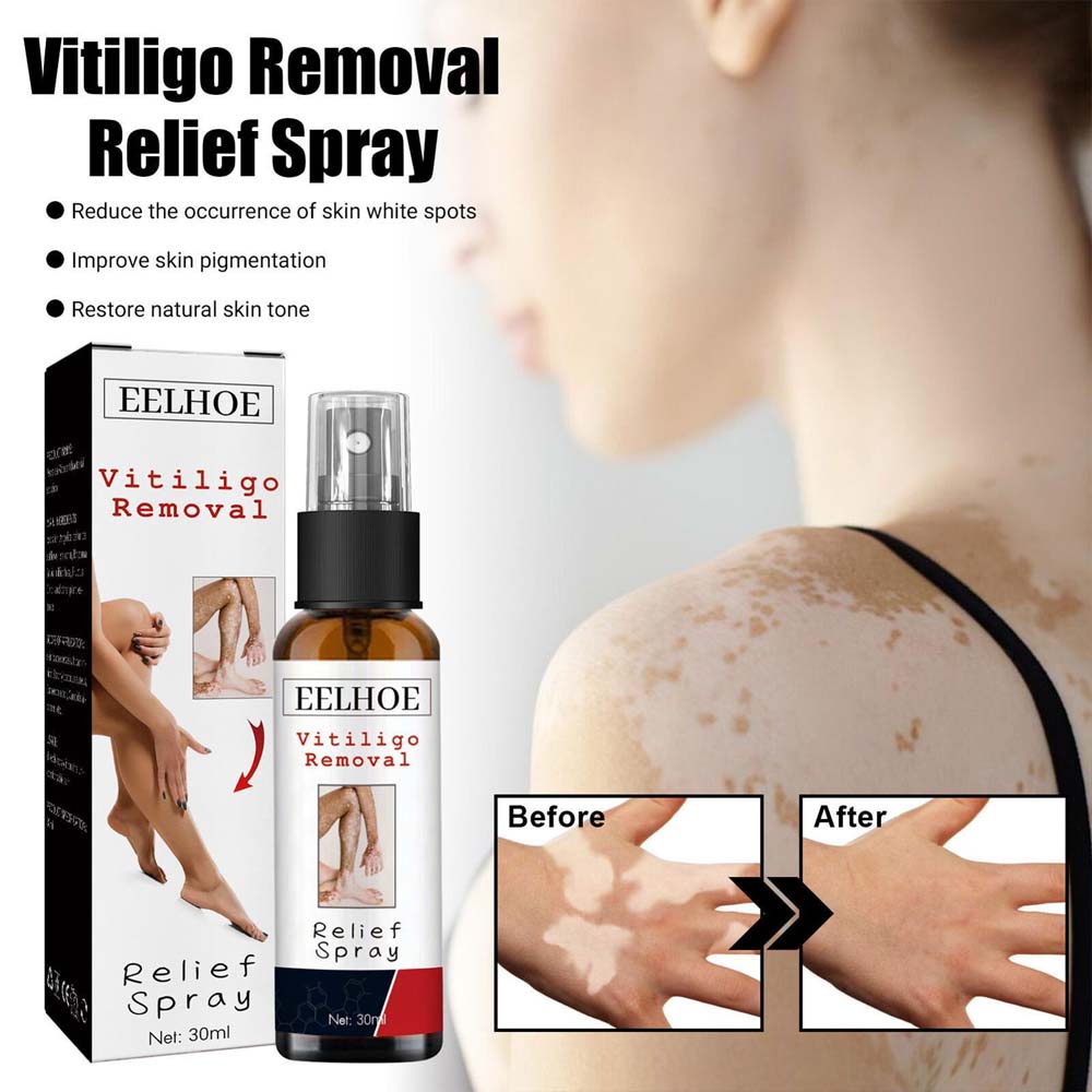 Best Vitiligo Removal Relief Spray Vitiligo Skin Repair Spray for Skin Care New