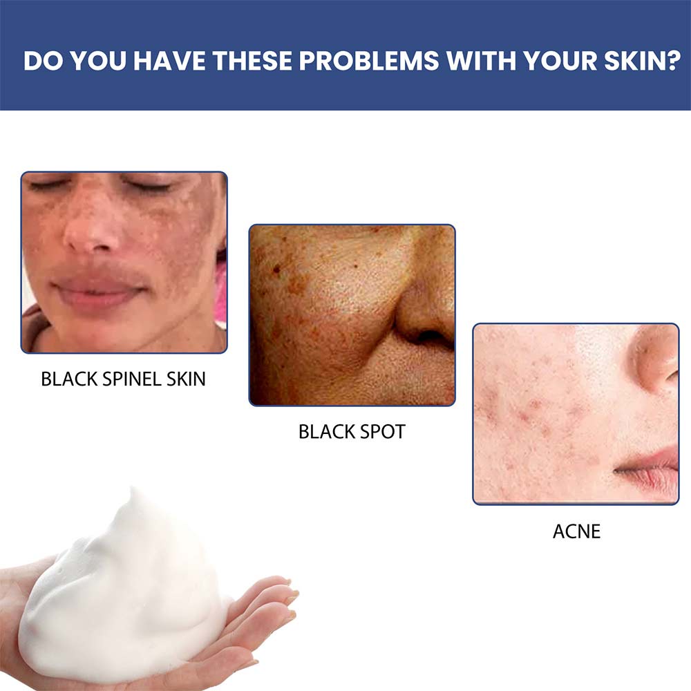 50ml Cleansing Lotion Moisturizing Relieving Dry Skin Facial Exfoliation Lighten Dark Pigmentation Facial Cleanser