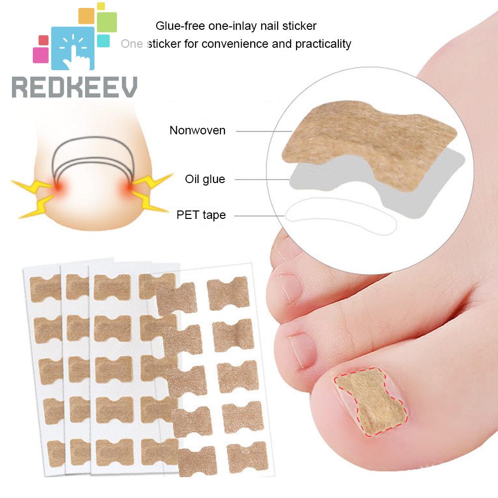 Set 10 Miếng Dán Chỉnh Sửa Móng Chân Tiện Dụng