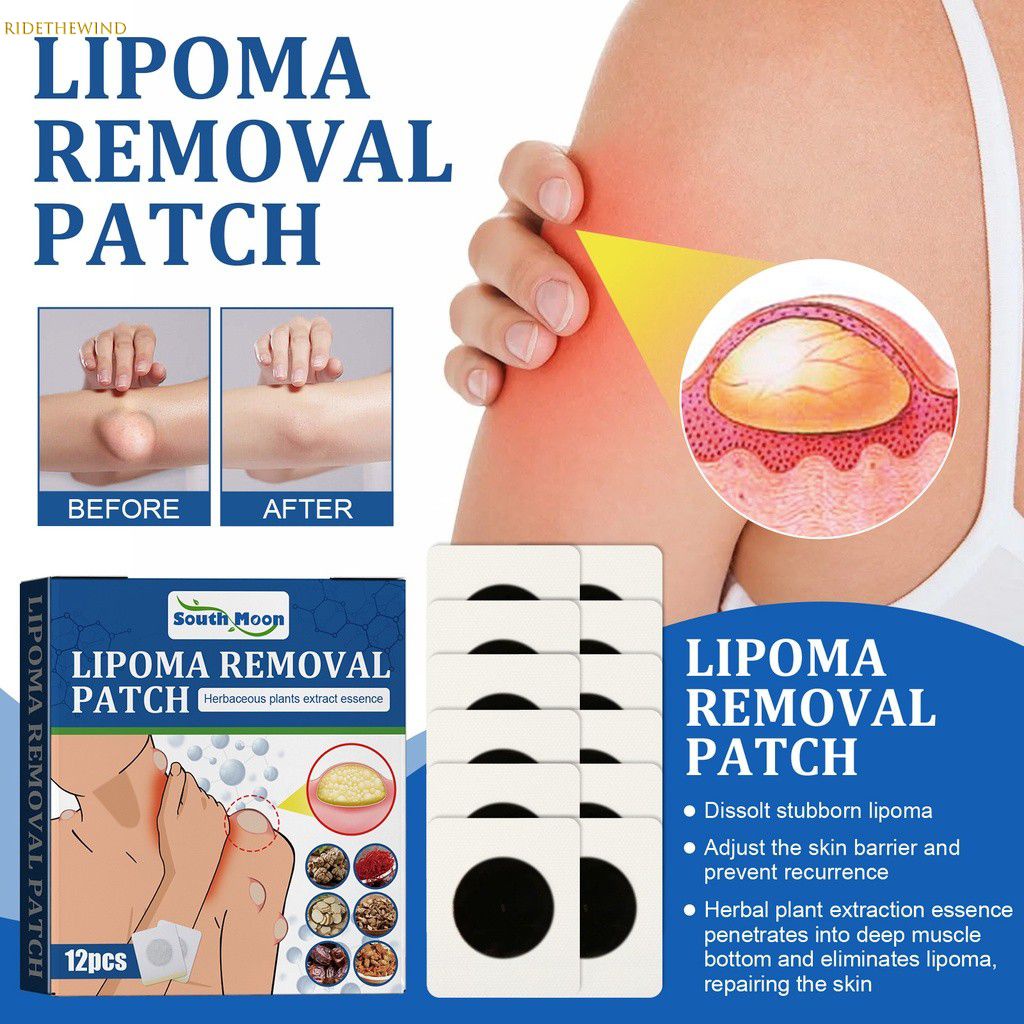 【Thanh Toán Khi Nhận Hàng】 Miếng Dán Loại Bỏ Lipoma South Moon Sản Chăm Sóc Cơ Thể Chiết Xuất Thực Vật Tự Nhiên Dưới Da Khối Lượng Tiêu Hóa Cơ Thể Làm Mới Không Gây Kích Ứng