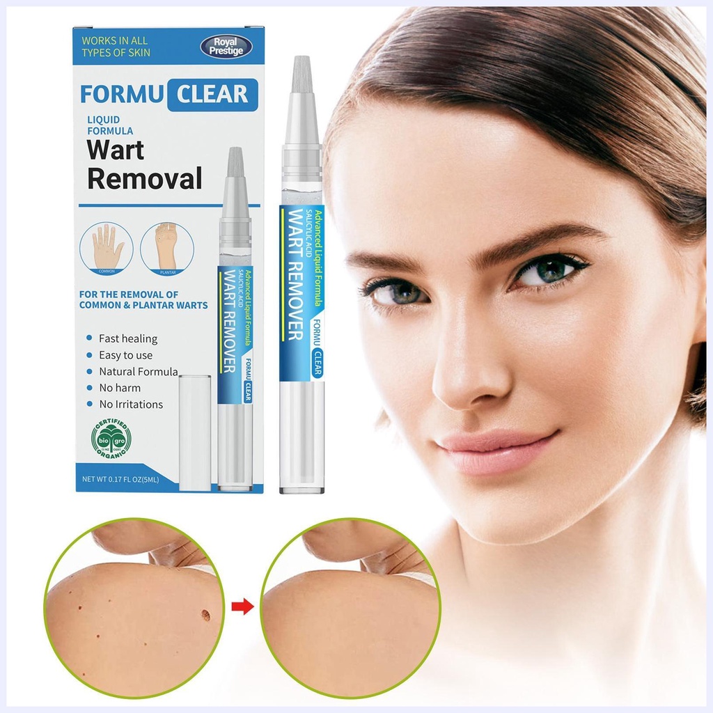 Bút Xóa Nốt Ruồi Và Mụn Thịt Dư Thông Dụng