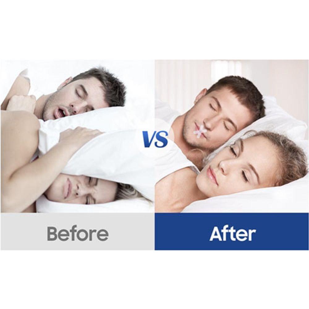 Băng Quấn Miệng Chống Ngáy Khi Ngủ Tiện Dụng