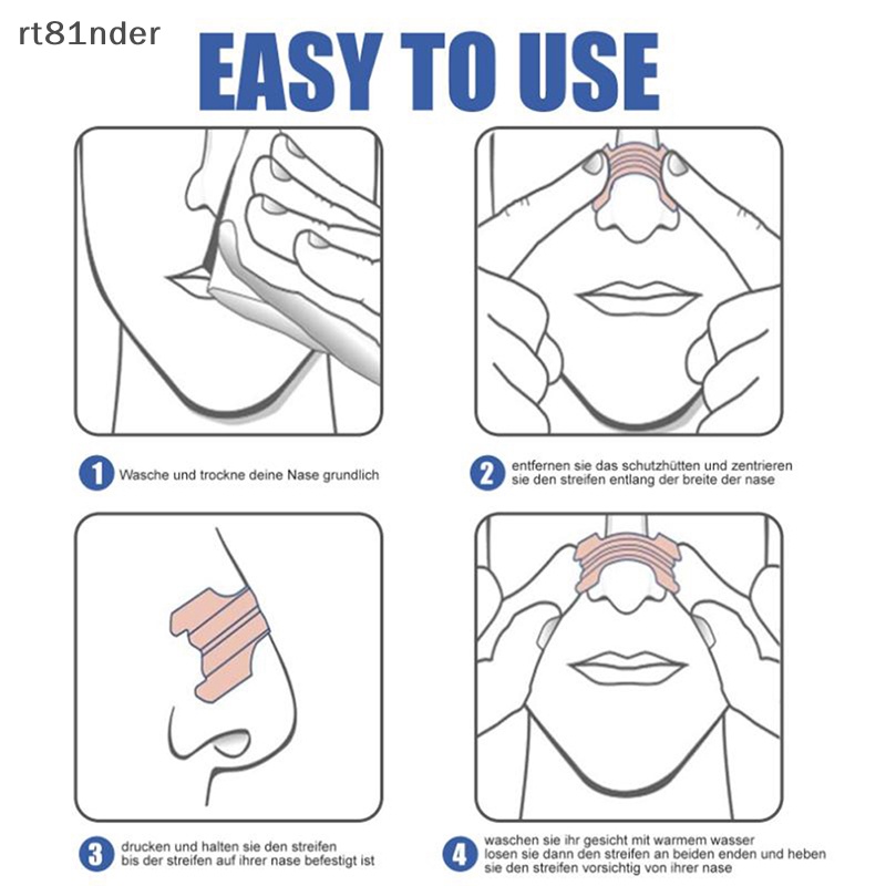 Rt Set 10 Dải Mũi Chống Ngáy Ngủ Tiện Dụng Chất Lượng Cao