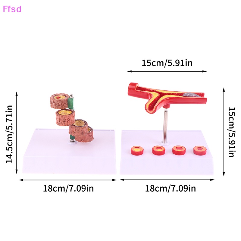 Tượng Vessel Con Người Nối Dài 50 Lần Cho Phòng Thí Nghiệm