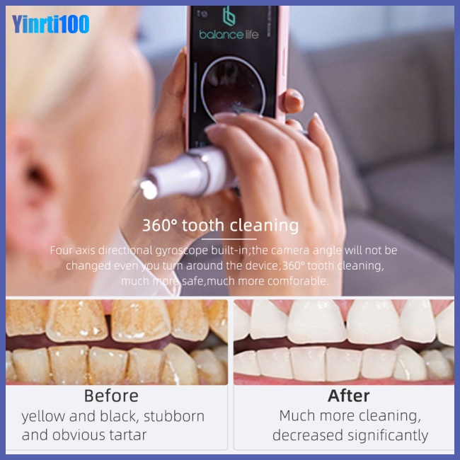 Máy Cạo Răng Bằng Sóng Siêu Âm Yinrti D3