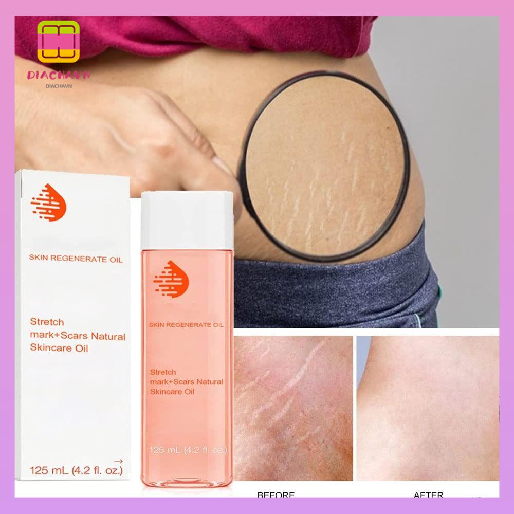DIACHAVN Tinh Dầu 125ml Giúp Hỗ trợ giảm sẹo Và Vết Thâm Do Mang Thai Cao Cấp