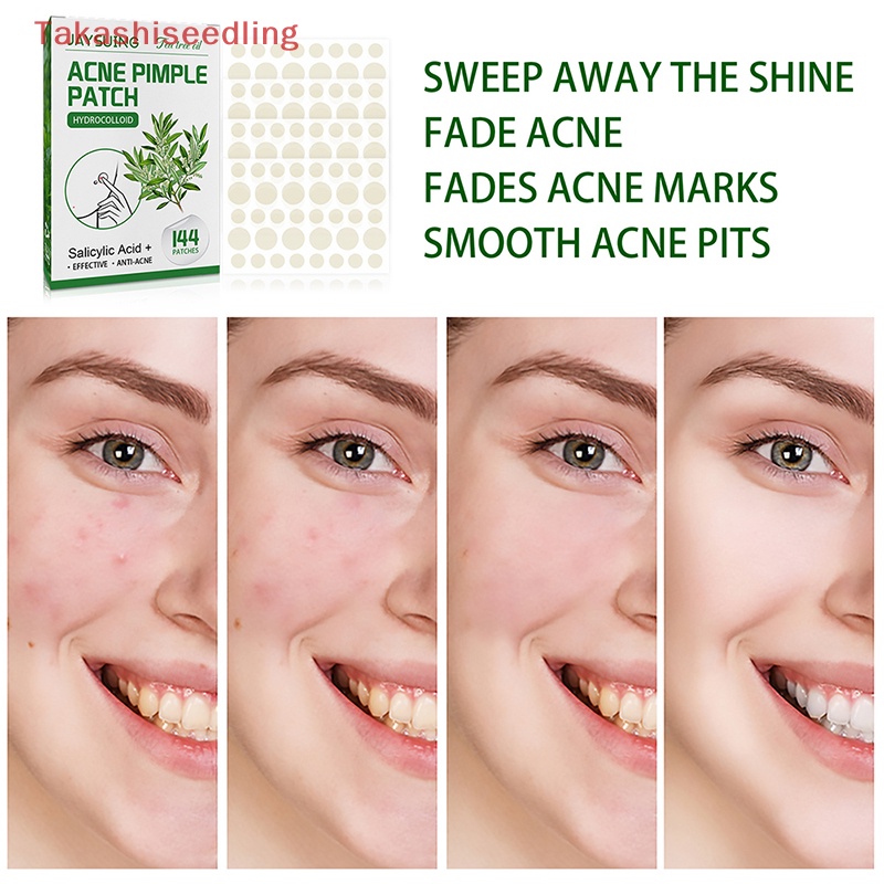 Bộ 144 Miếng Dán Hỗ Trợ Giảm Mụn Vô Hình Nhanh Chóng