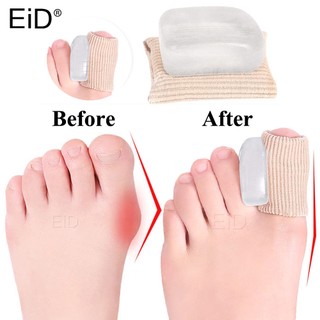 Set 2 đệm silicone tách ngón chân cái giảm đau