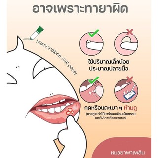 Kem nhiệt miệng Trinolone Oral Paste Thái Lan
