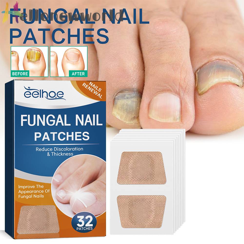 Bộ 32 Miếng Dán Điều Chỉnh Móng Tay Co Giãn Thoáng Khí Dễ Sử Dụng