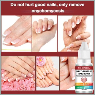 Tinh Chất Phục Hồi Móng Hư Tổn 10ml
