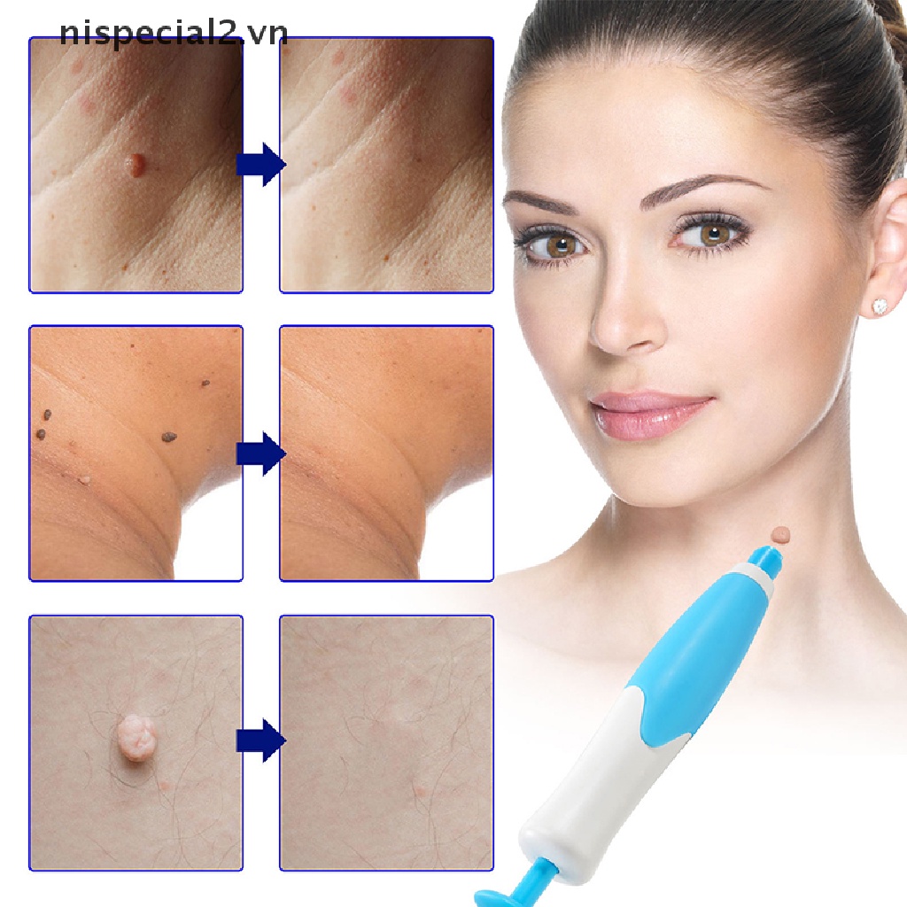 Bộ Dụng Cụ Loại Bỏ Vết Bẩn Trên Da 2 Trong 1 Tiện Dụng