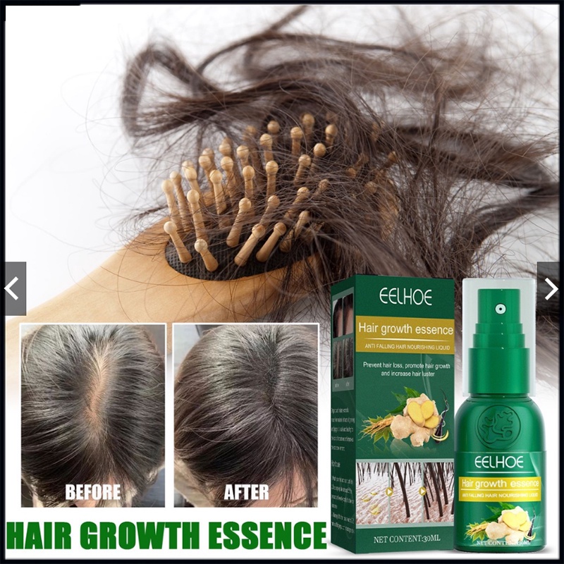 Tinh Dầu Xịt Kích Thích Mọc Tóc Trong Vòng 7 Ngày 30 / 50ML