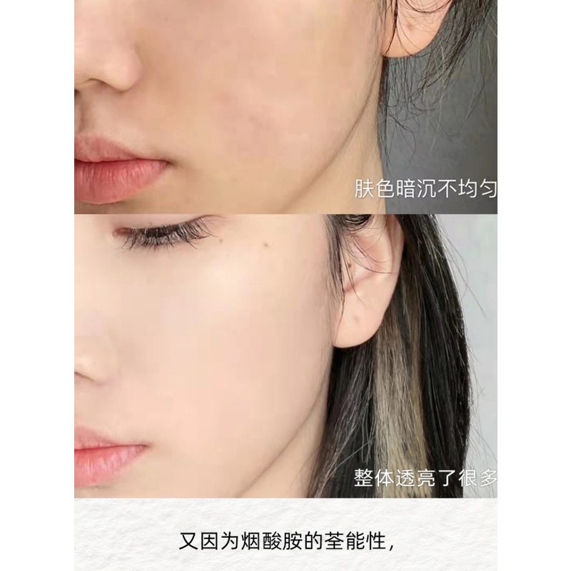 Tinh Chất Olay 40ml Làm Trắng Da Chống Nhạy Cảm