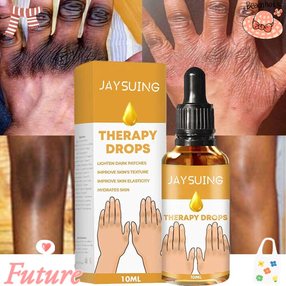 Tinh Dầu Loại Bỏ Melanin Giúp Làm Mờ Đốm Đen Cho Ngón Tay Và Cơ Thể