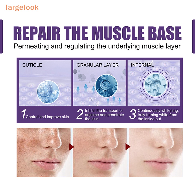 Cây Lăn Loại Bỏ Đốm Đen Làm Sáng Da Mặt 10ml