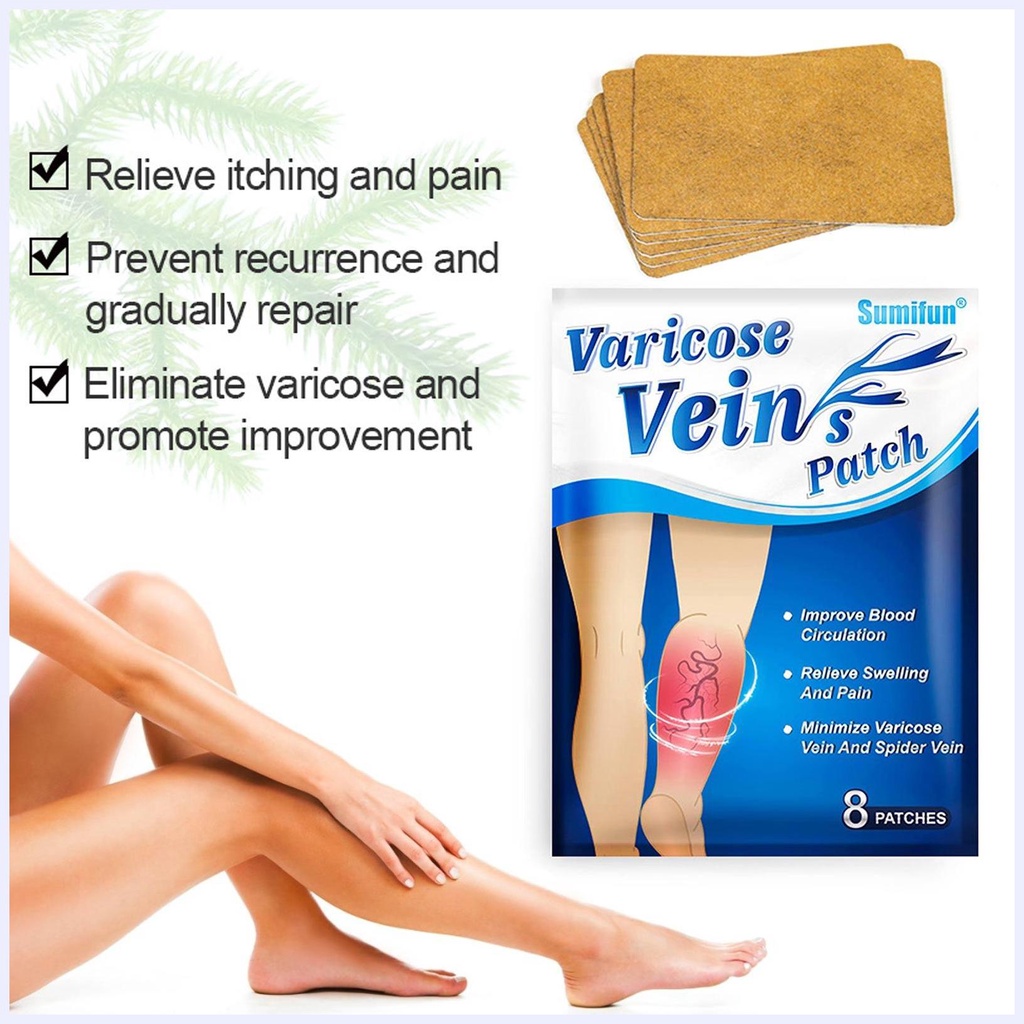 Miếng Dán Trị Giãn Tĩnh Mạch Trung Hoa Hiệu Quả