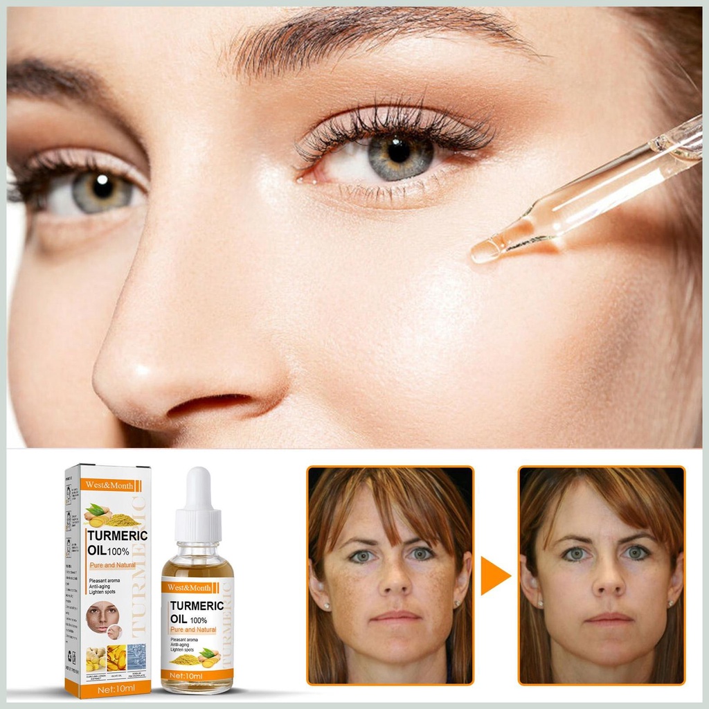 Tinh chất nghệ cho mặt 10ml dưỡng da mặt cần thiết chất lỏng dưỡng ẩm nghệ tự nhiên phục hồi da kiodvn