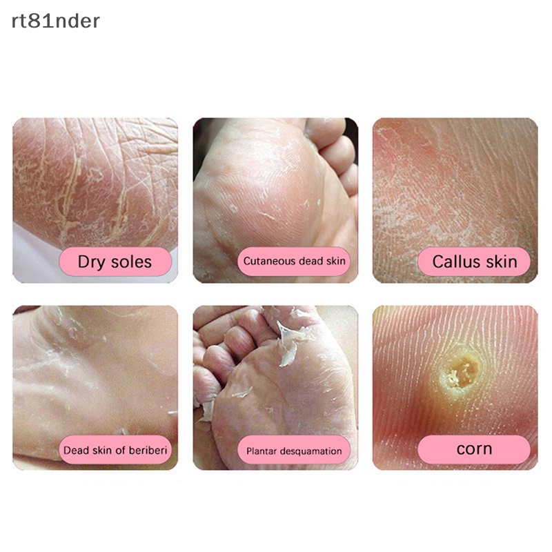 Dụng Cụ Dũa Loại Bỏ Da Chết Cho Chân Bằng Thép Không Gỉ Cứng Cáp