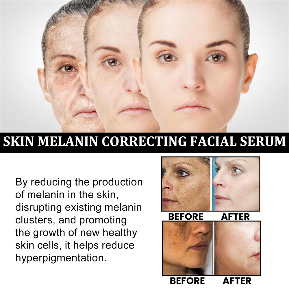 Serum điều chỉnh sắc tố da mặt JULYSTAR giảm vết thâm hàng ngày