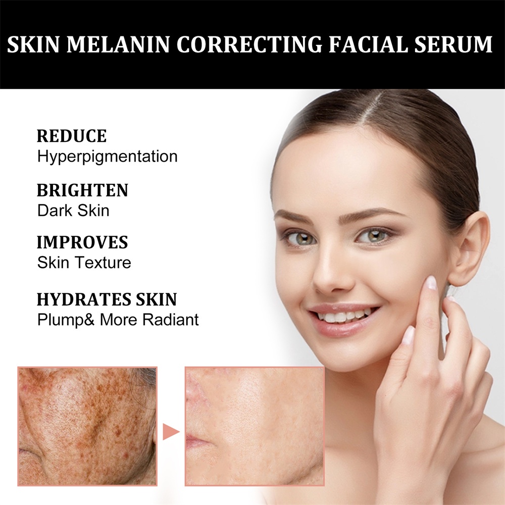 Serum điều chỉnh sắc tố da mặt JULYSTAR giảm vết thâm hàng ngày