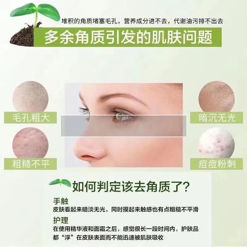 Gel Tẩy Tế Bào Chết Chiết Xuất Lô Hội Yinmei Làm Sạch Sâu Tẩy Tế Bào Chết Và Không Gây Kích Ứng Chăm Sóc Da