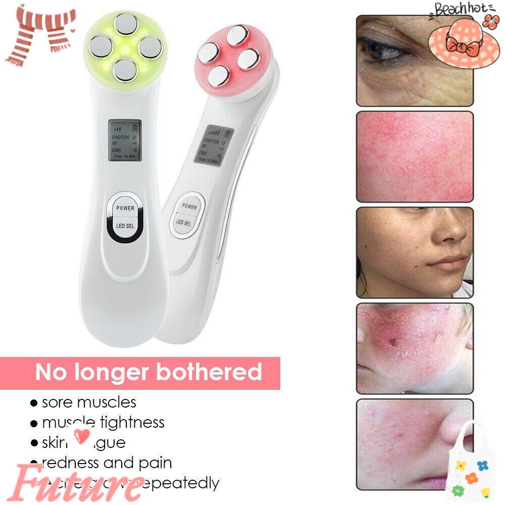 Máy Radio Tần Số Làm Săn Chắc Da Loại Bỏ Tàn Nhang