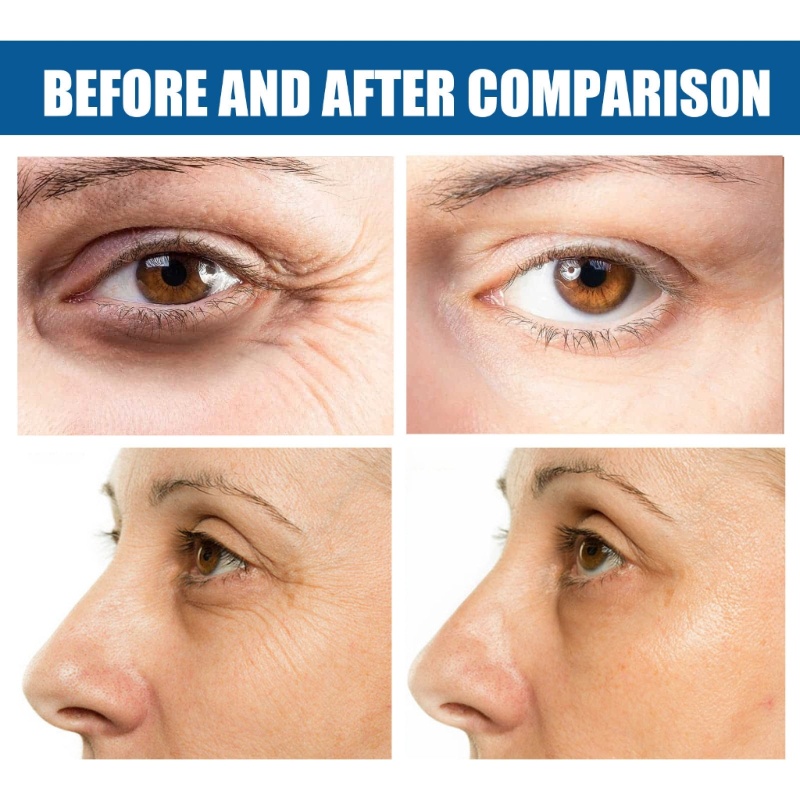 Set 6 Mặt Nạ Mắt Collagen EELHOE Dưỡng Ẩm Chống Nếp Nhăn Và Quầng Thâm YOUYO