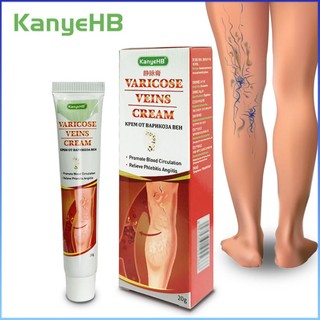 ⚡⚡COD kanyehb giãn tĩnh mạch Kem sửa chữa viêm mạch viêm tĩnh mạch đau Giun đất Nhện Chân Thuốc mỡ y tế tăng tốc lưu thông máu chiết xuất thảo dược để điều trị cơ thể 20g