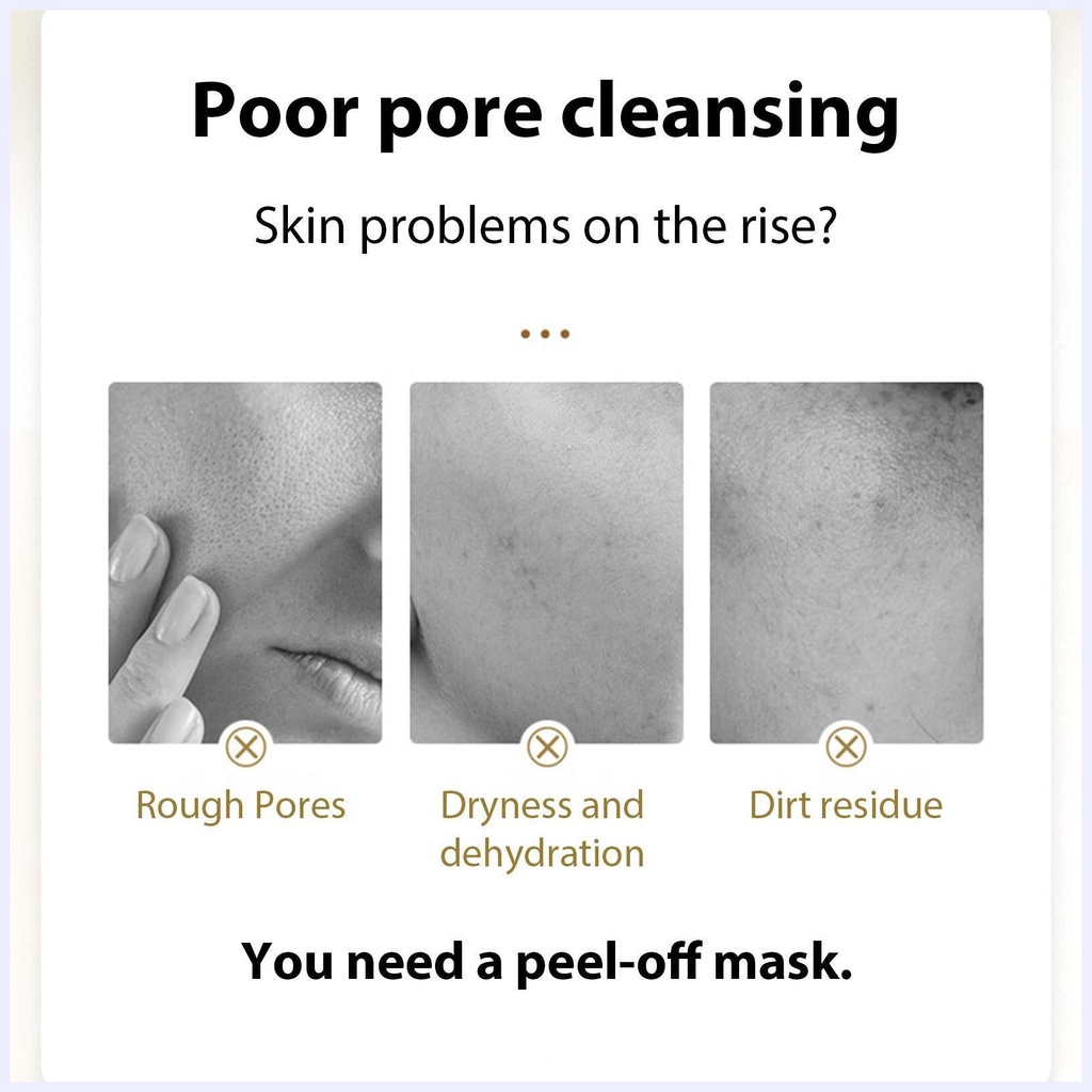 Retinol Snake Venom Peptide Gold Mask Làm sạch lỗ chân lông Loại bỏ mụn đầu đen Mặt nạ Tear Off Smear