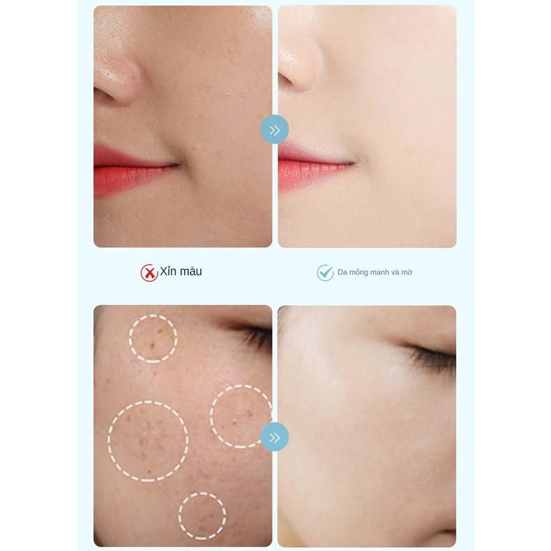 Kem Dưỡng Trắng Da 377 Giúp Loại Bỏ Tàn Nhang Và Làm Sáng Da kem dưỡng ẩm trắng da mặt 30g