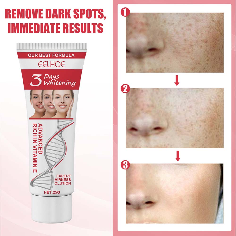 Eelhoe 3 Days Kojic Acid Whitening Moisturizing Cream Black Spot Repairing Cream Body Cream Removing Black Spots Depigmentation Brightening Moisturizing 25g