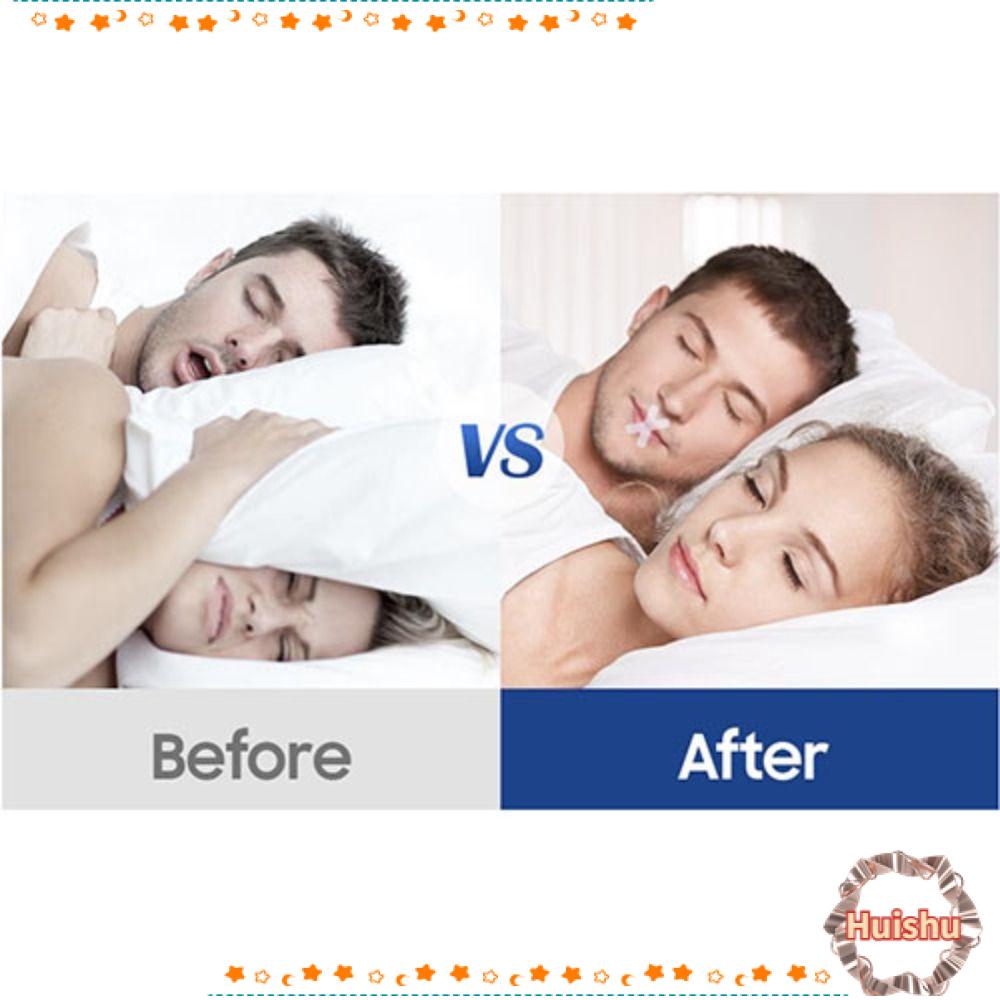 HS Băng Keo Dán Mũi Chống Ngáy Khi Ngủ Tiện Dụng
