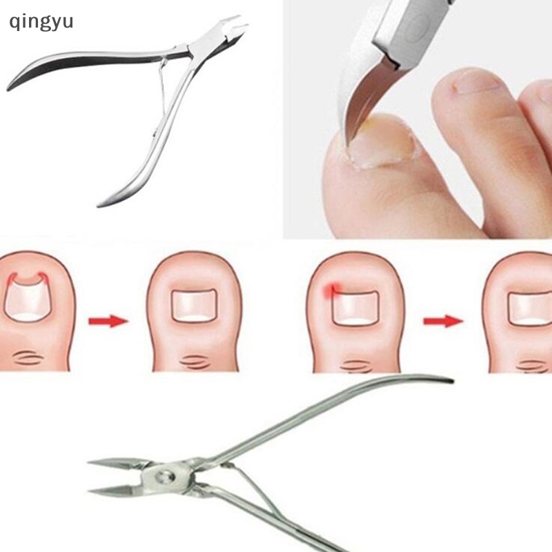 Bộ 2 Dụng Cụ Chăm Sóc Móng Chân Chất Lượng Cao