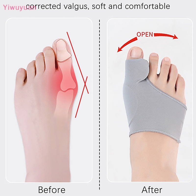 1 Cặp Dụng Cụ Chỉnh Hình Ngón Chân Cái Mới