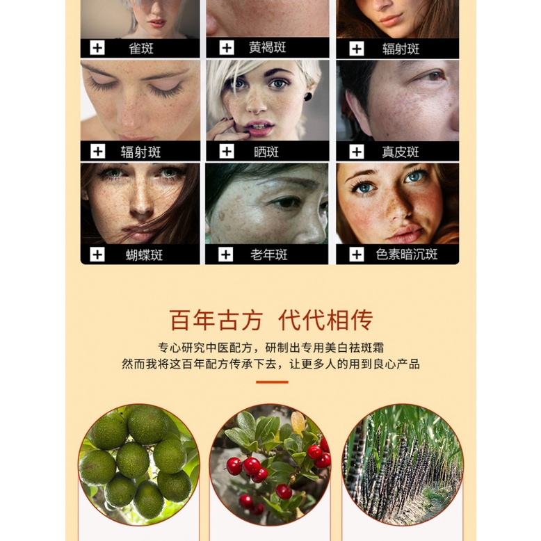Kem Trị Tàn Nhang Làm Trắng Da Cho Nữ